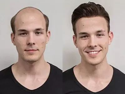 Men's wigs